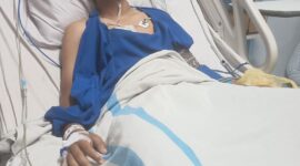 Seorang remaja 16 tahun dirawat intensif setelah ditembak OTK menggunakan senapan angin di Deli Serdang.